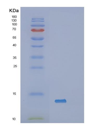 SDS-PAGE analysis of Human SAA1 (Serum Amyloid A-1 Protein) - Recombinant Protein, CAT# BLT-02751P, showing >85% purity under 15% SDS-PAGE (Reduced)Human SAA1 (Serum Amyloid A-1 Protein) - Recombinant Protein
