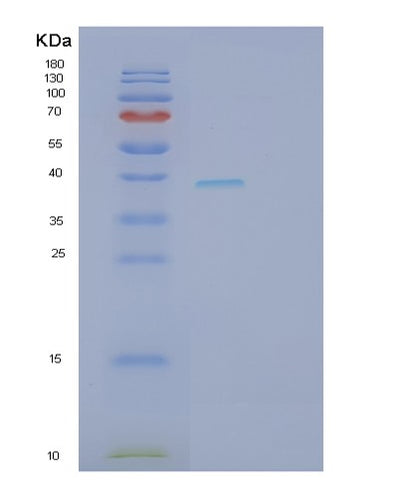 SDS-PAGE analysis of Human SFRP4 (Secreted Frizzled-Related Protein 4) - Recombinant Protein, CAT# BLT-02757P, showing >85% purity under 15% SDS-PAGE (Reduced)Human SFRP4 (Secreted Frizzled-Related Protein 4) - Recombinant Protein