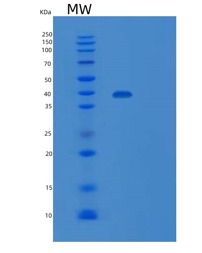SDS-PAGE analysis of Human SIRPA (Tyrosine-Protein Phosphatase Non-Receptor Type Substrate 1) - Recombinant Protein, CAT# BLT-02783P, showing >90% purity under 15% SDS-PAGE (Reduced)Human SIRPA (Tyrosine-Protein Phosphatase Non-Receptor Type Substrate 1) - Recombinant Protein