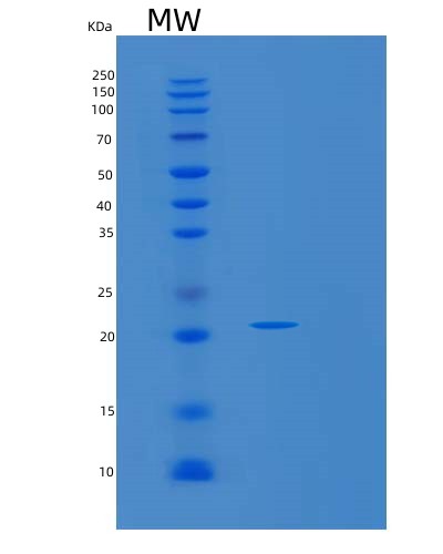 SDS-PAGE analysis of Human DIABLO (Diablo Iap-Binding Mitochondrial Protein) - Recombinant Protein, CATHuman DIABLO (Diablo Iap-Binding Mitochondrial Protein) - Recombinant Protein