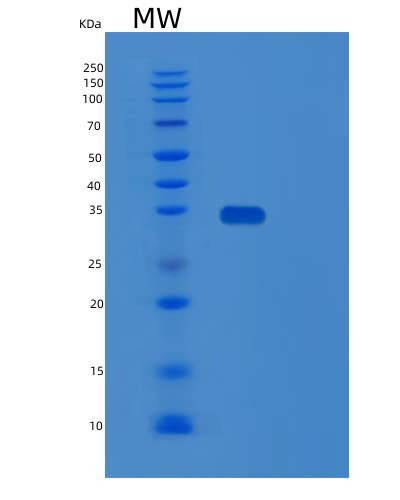 SDS-PAGE analysis of Human SPRY4 (Protein Sprouty Homolog 4) - Recombinant Protein, CAT# BLT-02862P, showing >95% purity under 15% SDS-PAGE (Reduced)Human SPRY4 (Protein Sprouty Homolog 4) - Recombinant Protein
