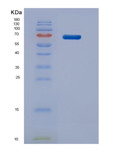 SDS-PAGE analysis of Mouse Stip1 (Stress-Induced-Phosphoprotein 1) - Recombinant Protein, CAT# BLT-02899P, showing >85% purity under 15% SDS-PAGE (Reduced)Mouse Stip1 (Stress-Induced-Phosphoprotein 1) - Recombinant Protein