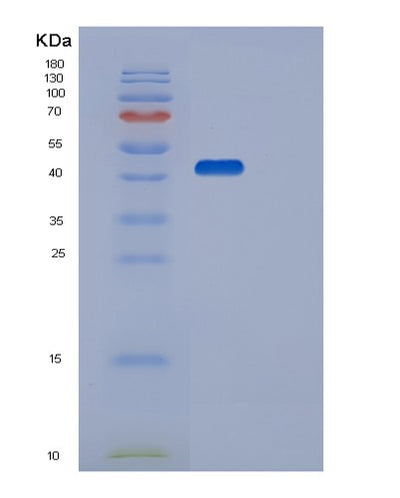 SDS-PAGE analysis of Human STK17B (Serine/Threonine-Protein Kinase 17B) - Recombinant Protein, CAT# BLT-02903P, showing >95% purity under 15% SDS-PAGE (Reduced)Human STK17B (Serine/Threonine-Protein Kinase 17B) - Recombinant Protein