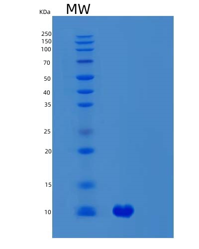 SDS-PAGE analysis of Human SVIP (Small Vcp/P97-Interacting Protein) - Recombinant Protein, CAT# BLT-02940P, showing >95% purity under 15% SDS-PAGE (Reduced)Human SVIP (Small Vcp/P97-Interacting Protein) - Recombinant Protein