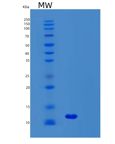SDS-PAGE analysis of Human SYCE3 (Synaptonemal Complex Central Element Protein 3) - Recombinant Protein, CAT# BLT-02941P, showing >90% purity under 15% SDS-PAGE (Reduced)Human SYCE3 (Synaptonemal Complex Central Element Protein 3) - Recombinant Protein