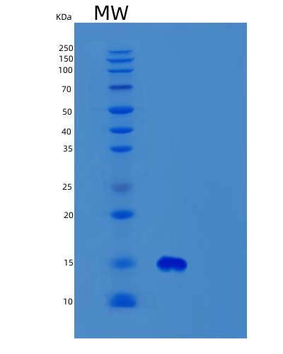 SDS-PAGE analysis of Human SYNJ2BP (Synaptojanin-2-Binding Protein) - Recombinant Protein, CAT# BLT-02946P, showing >95% purity under 15% SDS-PAGE (Reduced)Human SYNJ2BP (Synaptojanin-2-Binding Protein) - Recombinant Protein