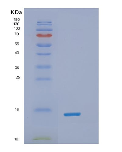 SDS-PAGE analysis of Human SNCA (Alpha-Synuclein) - Recombinant Protein, CAT# BLT-02951P, showing >95% purity under 15% SDS-PAGE (Reduced)Human SNCA (Alpha-Synuclein) - Recombinant Protein