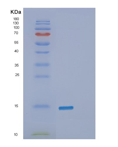 SDS-PAGE analysis of Human SNCB (Beta-Synuclein) - Recombinant Protein, CATHuman SNCB (Beta-Synuclein) - Recombinant Protein