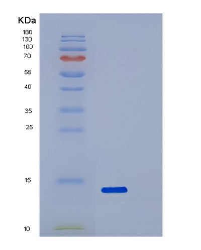 SDS-PAGE analysis of Human SNCA (Alpha-Synuclein) - Recombinant Protein, CAT# BLT-02954P, showing >95% purity under 15% SDS-PAGE (Reduced)Human SNCA (Alpha-Synuclein) - Recombinant Protein