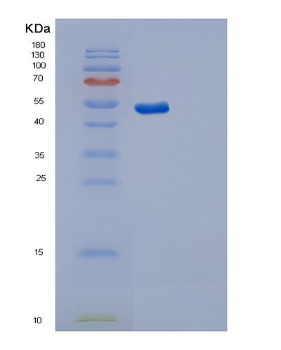 SDS-PAGE analysis of Human SYT11 (Synaptotagmin-11) - Recombinant Protein, CAT# BLT-02956P, showing >85% purity under 15% SDS-PAGE (Reduced)Human SYT11 (Synaptotagmin-11) - Recombinant Protein