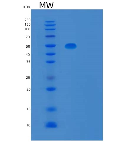 SDS-PAGE analysis of Human TBCEL (Tubulin-Specific Chaperone Cofactor E-Like Protein) - Recombinant Protein, CAT# BLT-02987P, showing >90% purity under 15% SDS-PAGE (Reduced)Human TBCEL (Tubulin-Specific Chaperone Cofactor E-Like Protein) - Recombinant Protein