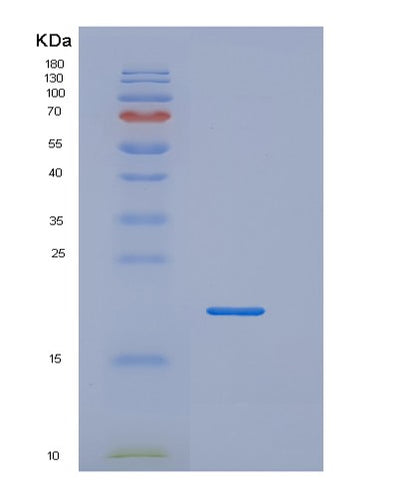SDS-PAGE analysis of Human LTA (Lymphotoxin-Alpha) - Recombinant Protein, CAT# BLT-03063P, showing >95% purity under 15% SDS-PAGE (Reduced)Human LTA (Lymphotoxin-Alpha) - Recombinant Protein
