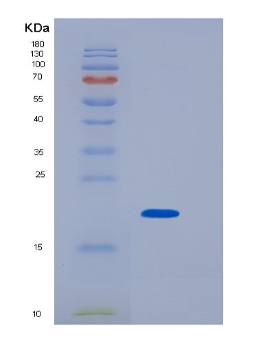 SDS-PAGE analysis of Human TSG101 (Tumor Susceptibility Gene 101 Protein) - Recombinant Protein, CATHuman TSG101 (Tumor Susceptibility Gene 101 Protein) - Recombinant Protein