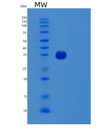 SDS-PAGE analysis of Human TTC1 (Tetratricopeptide Repeat Protein 1) - Recombinant Protein, CAT# BLT-03155P, showing >85% purity under 15% SDS-PAGE (Reduced)Human TTC1 (Tetratricopeptide Repeat Protein 1) - Recombinant Protein