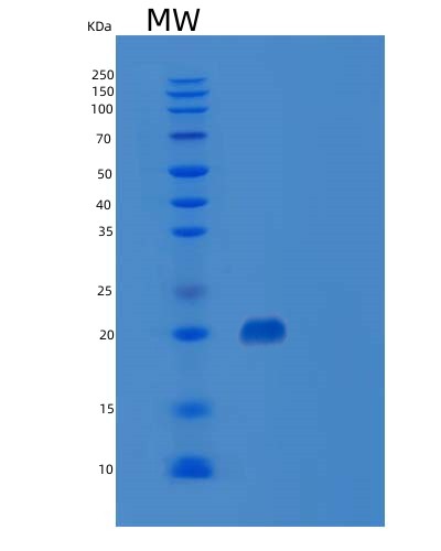 SDS-PAGE analysis of Human BSG (Basigin) - Recombinant Protein, CAT# BLT-03162P, showing >85% purity under 15% SDS-PAGE (Reduced)Human BSG (Basigin) - Recombinant Protein