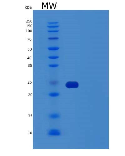 SDS-PAGE analysis of Human TNFRSF1B (Tumor Necrosis Factor Receptor Superfamily Member 1B) - Recombinant Protein, CAT# BLT-03164P, showing >95% purity under 15% SDS-PAGE (Reduced)Human TNFRSF1B (Tumor Necrosis Factor Receptor Superfamily Member 1B) - Recombinant Protein