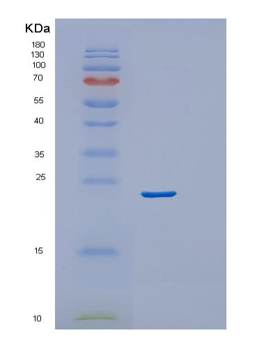 SDS-PAGE analysis of Human VEGFA (Vascular Endothelial Growth Factor A, Long Form) - Recombinant Protein, CATHuman VEGFA (Vascular Endothelial Growth Factor A, Long Form) - Recombinant Protein