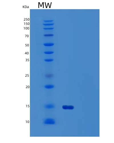 SDS-PAGE analysis of Human CTLA4 (Cytotoxic T-Lymphocyte Protein 4) - Recombinant Protein, CAT# BLT-03388P, showing >90% purity under 15% SDS-PAGE (Reduced)Human CTLA4 (Cytotoxic T-Lymphocyte Protein 4) - Recombinant Protein