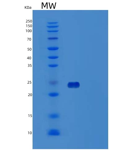 SDS-PAGE analysis of Human CD80 (T-Lymphocyte Activation Antigen Cd80) - Recombinant Protein, CAT# BLT-03399P, showing >90% purity under 15% SDS-PAGE (Reduced)Human CD80 (T-Lymphocyte Activation Antigen Cd80) - Recombinant Protein