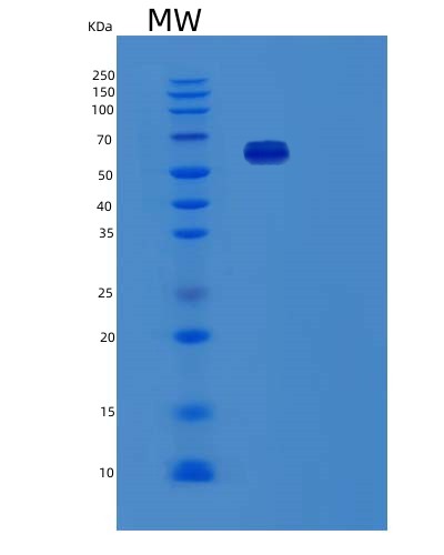 SDS-PAGE analysis of Human FN1 (Fibronectin) - Recombinant Protein, CATHuman FN1 (Fibronectin) - Recombinant Protein
