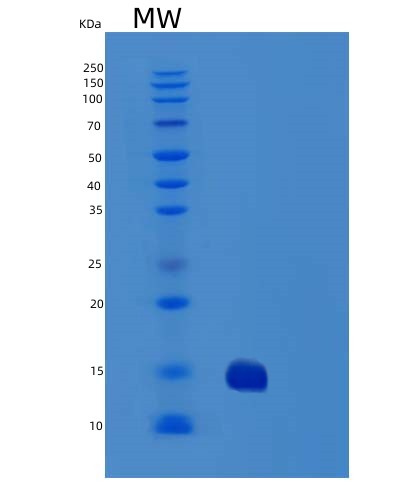 SDS-PAGE analysis of Human TNFRSF10B (Tumor Necrosis Factor Receptor Superfamily Member 10B) - Recombinant Protein, CATHuman TNFRSF10B (Tumor Necrosis Factor Receptor Superfamily Member 10B) - Recombinant Protein
