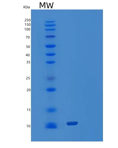 SDS-PAGE analysis of Human ACVR1 (Activin Receptor Type-1) - Recombinant Protein, CATHuman ACVR1 (Activin Receptor Type-1) - Recombinant Protein