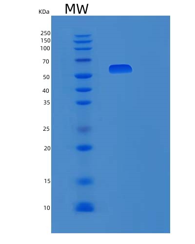 SDS-PAGE analysis of Human PDGFRB (Platelet-Derived Growth Factor Receptor Beta) - Recombinant Protein, CAT# BLT-03489P, showing >85% purity under 15% SDS-PAGE (Reduced)Human PDGFRB (Platelet-Derived Growth Factor Receptor Beta) - Recombinant Protein