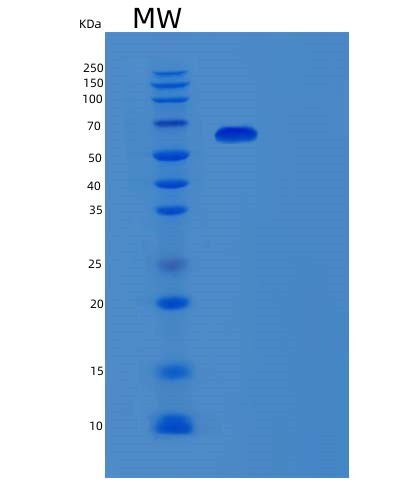 SDS-PAGE analysis of Human TNFRSF8 (Tumor Necrosis Factor Receptor Superfamily Member 8) - Recombinant Protein, CAT# BLT-03570P, showing >85% purity under 15% SDS-PAGE (Reduced)Human TNFRSF8 (Tumor Necrosis Factor Receptor Superfamily Member 8) - Recombinant Protein