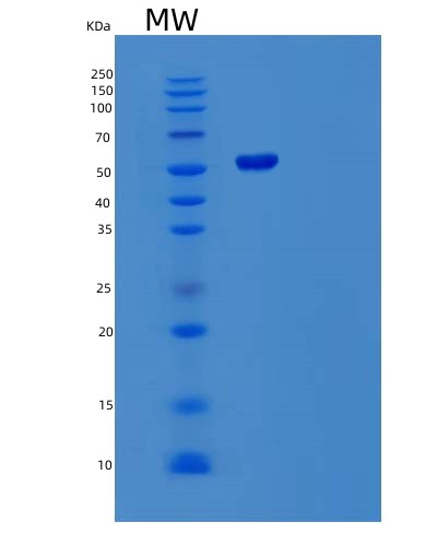 SDS-PAGE analysis of Human CNDP1 (Beta-Ala-His Dipeptidase) - Recombinant Protein, CAT# BLT-03594P, showing >85% purity under 15% SDS-PAGE (Reduced)Human CNDP1 (Beta-Ala-His Dipeptidase) - Recombinant Protein