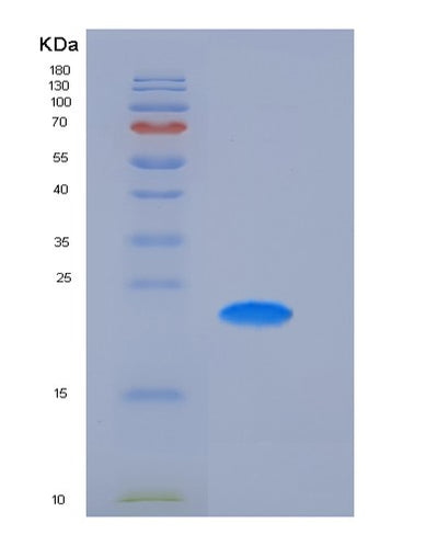 SDS-PAGE analysis of Human FCGR2A (Low Affinity Immunoglobulin Gamma Fc Region Receptor Ii-A) - Recombinant Protein, CAT# BLT-05430P, showing >90% purity under 15% SDS-PAGE (Reduced)Human FCGR2A (Low Affinity Immunoglobulin Gamma Fc Region Receptor Ii-A) - Recombinant Protein