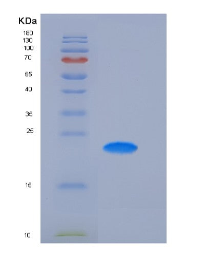 SDS-PAGE analysis of Human FCGR2A (Low Affinity Immunoglobulin Gamma Fc Region Receptor Ii-A) - Recombinant Protein, CATHuman FCGR2A (Low Affinity Immunoglobulin Gamma Fc Region Receptor Ii-A) - Recombinant Protein
