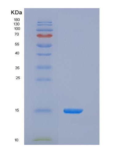 SDS-PAGE analysis of Human CD164 (Sialomucin Core Protein 24) - Recombinant Protein, CAT# BLT-05434P, showing >90% purity under 15% SDS-PAGE (Reduced)Human CD164 (Sialomucin Core Protein 24) - Recombinant Protein