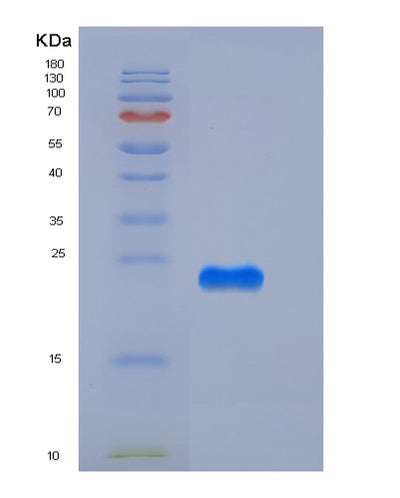 SDS-PAGE analysis of Mouse Creg1 (Protein Creg1) - Recombinant Protein, CAT# BLT-05436P, showing >95% purity under 15% SDS-PAGE (Reduced)Mouse Creg1 (Protein Creg1) - Recombinant Protein