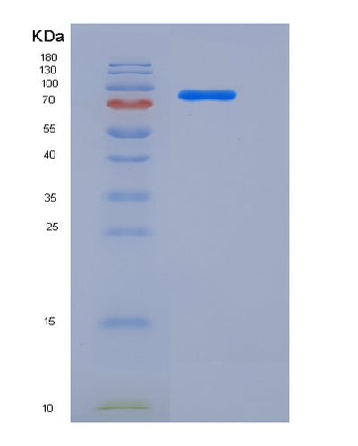 SDS-PAGE analysis of Human AKT3 (Rac-Gamma Serine/Threonine-Protein Kinase) - Recombinant Protein, CAT# BLT-05438P, showing >85% purity under 15% SDS-PAGE (Reduced)Human AKT3 (Rac-Gamma Serine/Threonine-Protein Kinase) - Recombinant Protein