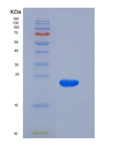 SDS-PAGE analysis of Human KRAS (Gtpase Kras) - Recombinant Protein, CAT# BLT-05439P, showing >95% purity under 15% SDS-PAGE (Reduced)Human KRAS (Gtpase Kras) - Recombinant Protein