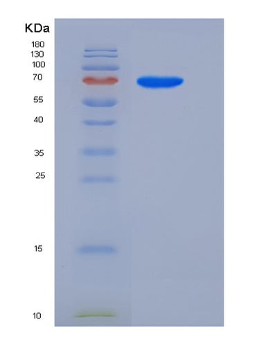 SDS-PAGE analysis of Human SEMA6A (Semaphorin-6A) - Recombinant Protein, CAT# BLT-05440P, showing >90% purity under 15% SDS-PAGE (Reduced)Human SEMA6A (Semaphorin-6A) - Recombinant Protein