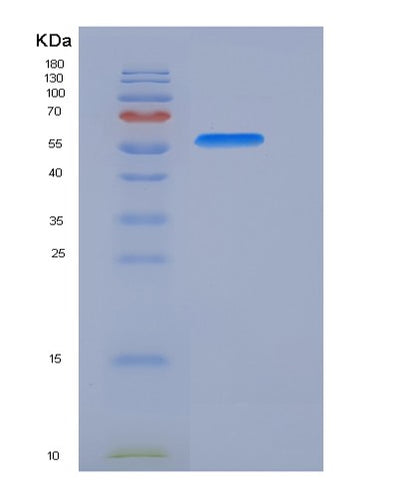 SDS-PAGE analysis of Human AKT1 (Rac-Alpha Serine/Threonine-Protein Kinase) - Recombinant Protein, CAT# BLT-05443P, showing >90% purity under 15% SDS-PAGE (Reduced)Human AKT1 (Rac-Alpha Serine/Threonine-Protein Kinase) - Recombinant Protein