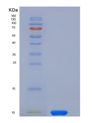 SDS-PAGE analysis of Human COL6A3 (Collagen Alpha-3(Vi) Chain) - Recombinant Protein, CAT# BLT-05446P, showing >85% purity under 15% SDS-PAGE (Reduced)Human COL6A3 (Collagen Alpha-3(Vi) Chain) - Recombinant Protein