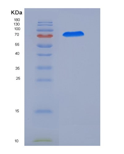 SDS-PAGE analysis of Human CAMKV (Cam Kinase-Like Vesicle-Associated Protein) - Recombinant Protein, CATHuman CAMKV (Cam Kinase-Like Vesicle-Associated Protein) - Recombinant Protein