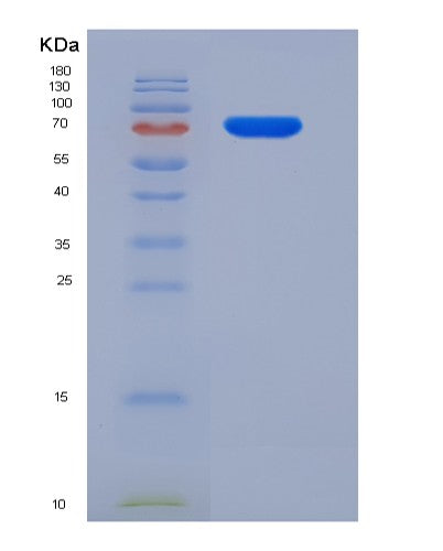 SDS-PAGE analysis of Mouse Scarb1 (Scavenger Receptor Class B Member 1) - Recombinant Protein, CATMouse Scarb1 (Scavenger Receptor Class B Member 1) - Recombinant Protein