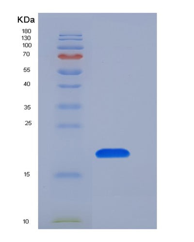 SDS-PAGE analysis of Human GKN1 (Gastrokine-1) - Recombinant Protein, CAT# BLT-05450P, showing >90% purity under 15% SDS-PAGE (Reduced)Human GKN1 (Gastrokine-1) - Recombinant Protein