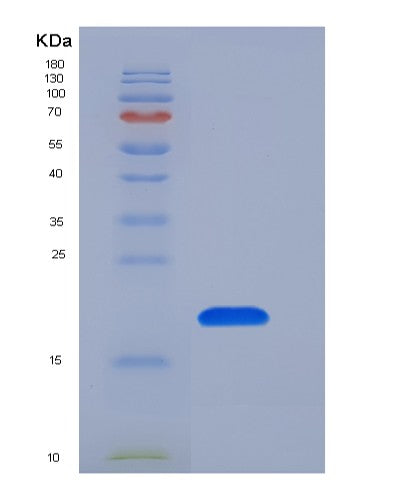 SDS-PAGE analysis of Human GKN1 (Gastrokine-1) - Recombinant Protein, CATHuman GKN1 (Gastrokine-1) - Recombinant Protein