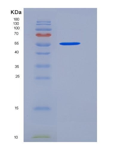 SDS-PAGE analysis of Human ALPL (Alkaline Phosphatase, Tissue-Nonspecific Isozyme) - Recombinant Protein, CATHuman ALPL (Alkaline Phosphatase, Tissue-Nonspecific Isozyme) - Recombinant Protein