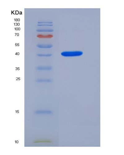 SDS-PAGE analysis of Mouse Acp3 (Prostatic Acid Phosphatase) - Recombinant Protein, CAT# BLT-05452P, showing >95% purity under 15% SDS-PAGE (Reduced)Mouse Acp3 (Prostatic Acid Phosphatase) - Recombinant Protein