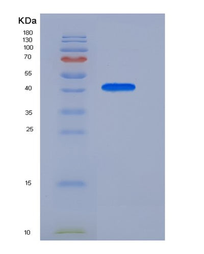 SDS-PAGE analysis of Human APOA4 (Apolipoprotein A-Iv) - Recombinant Protein, CAT# BLT-05457P, showing >85% purity under 15% SDS-PAGE (Reduced)Human APOA4 (Apolipoprotein A-Iv) - Recombinant Protein