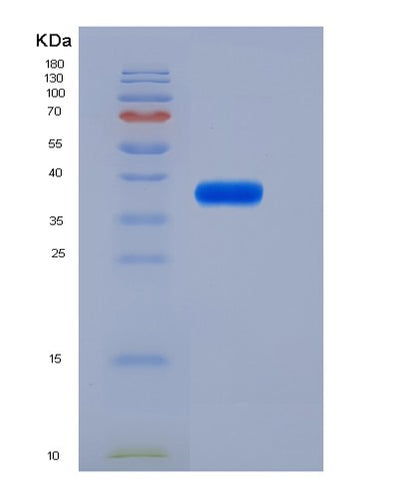 SDS-PAGE analysis of Mouse Il6ra (Interleukin-6 Receptor Subunit Alpha) - Recombinant Protein, CAT# BLT-05459P, showing >85% purity under 15% SDS-PAGE (Reduced)Mouse Il6ra (Interleukin-6 Receptor Subunit Alpha) - Recombinant Protein