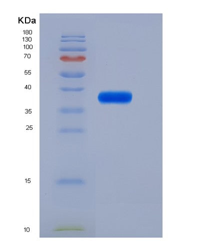 SDS-PAGE analysis of Mouse Il6ra (Interleukin-6 Receptor Subunit Alpha) - Recombinant Protein, CATMouse Il6ra (Interleukin-6 Receptor Subunit Alpha) - Recombinant Protein