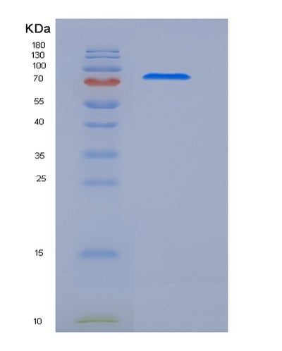 SDS-PAGE analysis of Human MEGF10 (Multiple Epidermal Growth Factor-Like Domains Protein 10) - Recombinant Protein, CAT# BLT-05462P, showing >85% purity under 15% SDS-PAGE (Reduced)Human MEGF10 (Multiple Epidermal Growth Factor-Like Domains Protein 10) - Recombinant Protein
