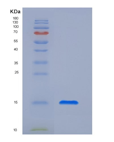 SDS-PAGE analysis of Human CTLA4 (Cytotoxic T-Lymphocyte Protein 4) - Recombinant Protein, CATHuman CTLA4 (Cytotoxic T-Lymphocyte Protein 4) - Recombinant Protein