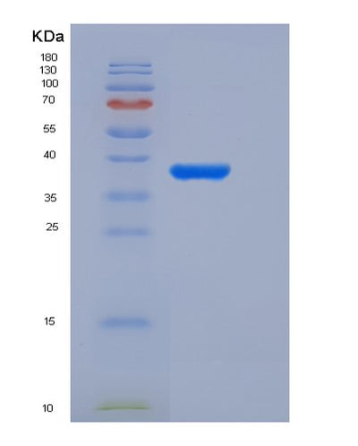 SDS-PAGE analysis of Human ACYP2 (Acylphosphatase-2) - Recombinant Protein, CAT# BLT-05464P, showing >90% purity under 15% SDS-PAGE (Reduced)Human ACYP2 (Acylphosphatase-2) - Recombinant Protein